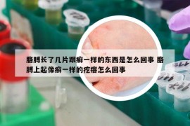胳膊長了幾片跟癬一樣的東西是怎么回事 胳膊上起像癬一樣的疙瘩怎么回事
