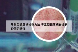 尋常型銀屑病檢查方法 尋常型銀屑病有診斷價(jià)值的特征