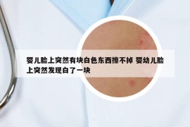 嬰兒臉上突然有塊白色東西擦不掉 嬰幼兒臉上突然發(fā)現(xiàn)白了一塊