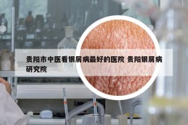 貴陽(yáng)市中醫(yī)看銀屑病最好的醫(yī)院 貴陽(yáng)銀屑病研究院