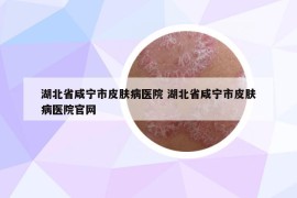 湖北省咸寧市皮膚病醫(yī)院 湖北省咸寧市皮膚病醫(yī)院官網(wǎng)