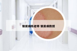 銀屑病陳老師 銀屑病教授