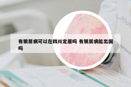 有銀屑病可以在四川定居嗎 有銀屑病能出國嗎