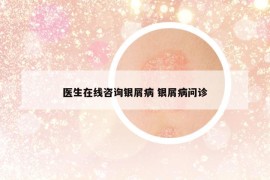 醫(yī)生在線咨詢銀屑病 銀屑病問診