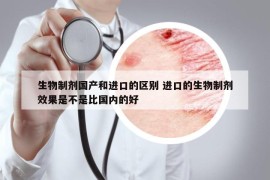 生物制劑國產(chǎn)和進口的區(qū)別 進口的生物制劑效果是不是比國內(nèi)的好