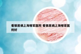 看銀屑病上海哪家醫(yī)院 看銀屑病上海哪家醫(yī)院好