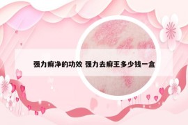 強(qiáng)力癬凈的功效 強(qiáng)力去癬王多少錢(qián)一盒