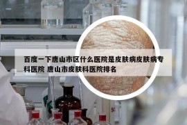 百度一下唐山市區(qū)什么醫(yī)院是皮膚病皮膚病專科醫(yī)院 唐山市皮膚科醫(yī)院排名