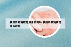 膚康冷敷凝膠是激素藥類嗎 膚康冷敷凝膠是什么成分