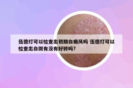 伍德燈可以檢查出初期白癜風(fēng)嗎 伍德燈可以檢查出白斑有沒(méi)有好轉(zhuǎn)嗎?