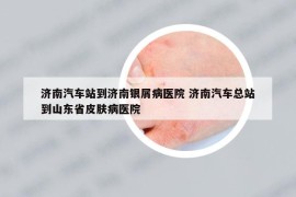 濟(jì)南汽車站到濟(jì)南銀屑病醫(yī)院 濟(jì)南汽車總站到山東省皮膚病醫(yī)院