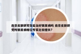 南京皮膚研究生能治好銀屑病嗎 南京皮膚研究所銀屑病哪位專家比較擅長(zhǎng)?