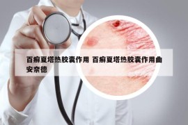 百癬夏塔熱膠囊作用 百癬夏塔熱膠囊作用曲安奈德