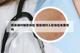 銀屑病對輔警體檢 銀屑病對入職體檢有要求嗎