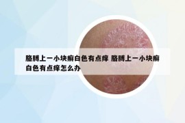胳膊上一小塊癬白色有點癢 胳膊上一小塊癬白色有點癢怎么辦
