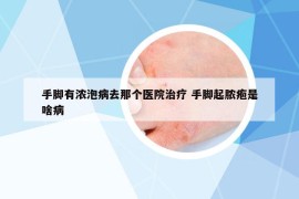 手腳有濃泡病去那個(gè)醫(yī)院治療 手腳起膿皰是啥病
