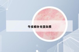 牛皮癬補(bǔ)充蛋白質(zhì)