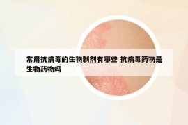 常用抗病毒的生物制劑有哪些 抗病毒藥物是生物藥物嗎