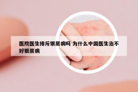 醫(yī)院醫(yī)生排斥銀屑病嗎 為什么中國醫(yī)生治不好銀屑病