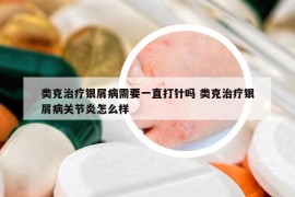 類克治療銀屑病需要一直打針嗎 類克治療銀屑病關(guān)節(jié)炎怎么樣