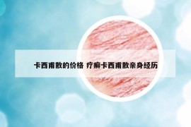 卡西甫散的價(jià)格 療癬卡西甫散親身經(jīng)歷