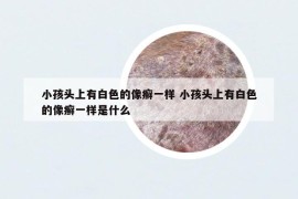 小孩頭上有白色的像癬一樣 小孩頭上有白色的像癬一樣是什么