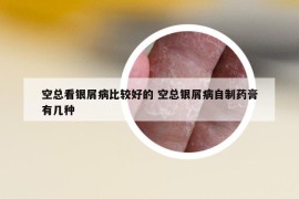 空總看銀屑病比較好的 空總銀屑病自制藥膏有幾種