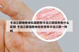 卡泊三醇陪他米松凝膠和卡泊三醇搽劑有什么區(qū)別 卡泊三醇倍他米松軟膏和卡泊三醇一樣嗎