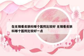 在無錫看皮膚科哪個醫(yī)院比較好 無錫看皮膚科哪個醫(yī)院比較好一點