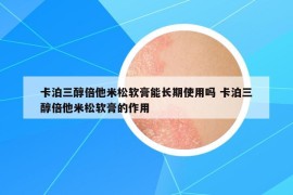 卡泊三醇倍他米松軟膏能長(zhǎng)期使用嗎 卡泊三醇倍他米松軟膏的作用