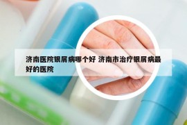 濟南醫(yī)院銀屑病哪個好 濟南市治療銀屑病最好的醫(yī)院