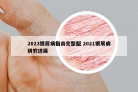 2023銀屑病指南完整版 2021銀屑病研究進展