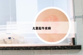 兒童起牛皮癬