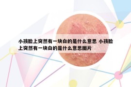小孩臉上突然有一塊白的是什么意思 小孩臉上突然有一塊白的是什么意思圖片