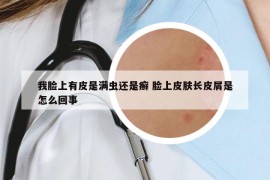 我臉上有皮是滿蟲還是癬 臉上皮膚長皮屑是怎么回事