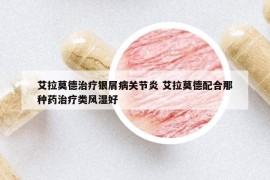艾拉莫德治療銀屑病關(guān)節(jié)炎 艾拉莫德配合那種藥治療類風(fēng)濕好