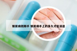 銀屑病初期手 銀屑病手上的多久才能消退