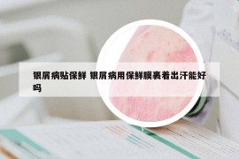 銀屑病貼保鮮 銀屑病用保鮮膜裹著出汗能好嗎