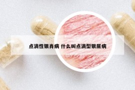 點滴性銀肖病 什么叫點滴型銀屑病