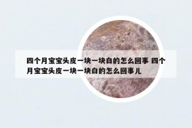四個(gè)月寶寶頭皮一塊一塊白的怎么回事 四個(gè)月寶寶頭皮一塊一塊白的怎么回事兒