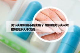關(guān)節(jié)炎銀屑病不能走路了 銀屑病關(guān)節(jié)炎可以控制到多久不發(fā)病