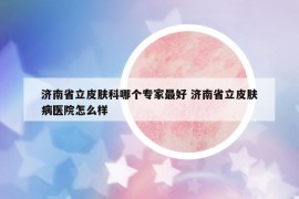 濟(jì)南省立皮膚科哪個(gè)專(zhuān)家最好 濟(jì)南省立皮膚病醫(yī)院怎么樣