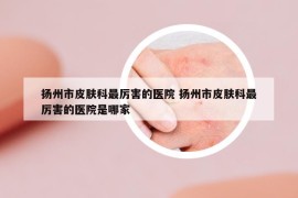 揚(yáng)州市皮膚科最厲害的醫(yī)院 揚(yáng)州市皮膚科最厲害的醫(yī)院是哪家