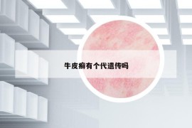 牛皮癬有個(gè)代遺傳嗎