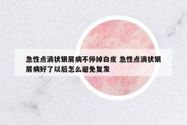急性點(diǎn)滴狀銀屑病不停掉白皮 急性點(diǎn)滴狀銀屑病好了以后怎么避免復(fù)發(fā)