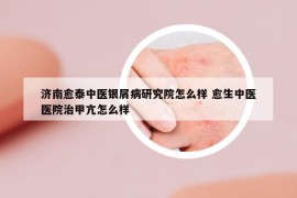 濟(jì)南愈泰中醫(yī)銀屑病研究院怎么樣 愈生中醫(yī)醫(yī)院治甲亢怎么樣