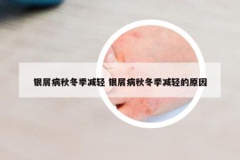 銀屑病秋冬季減輕 銀屑病秋冬季減輕的原因