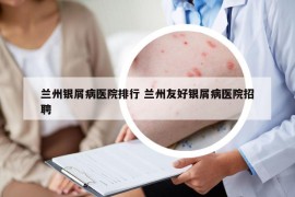 蘭州銀屑病醫(yī)院排行 蘭州友好銀屑病醫(yī)院招聘