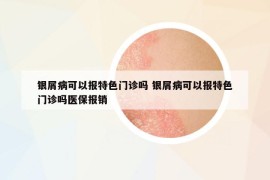 銀屑病可以報特色門診嗎 銀屑病可以報特色門診嗎醫(yī)保報銷