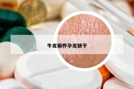 牛皮癬懷孕皮膚干